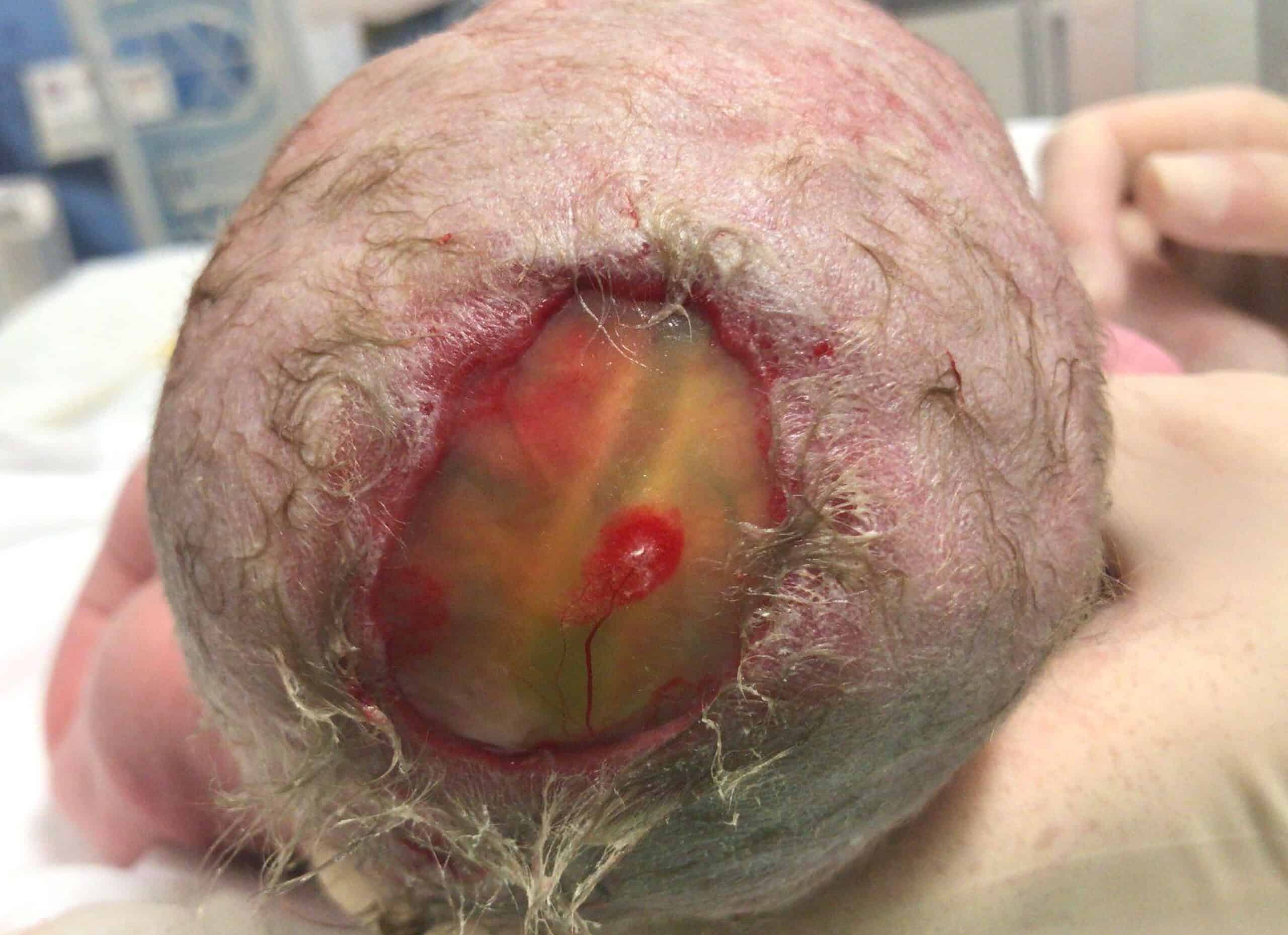 ČNeoS • NeoQuiz Dermatologie 1 scaled
